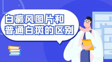 症状危害-皮肤白斑是白癜风吗